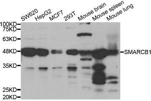 Western blot analysis of extracts of various cell lines, using SMARCB1 antibody. (SMARCB1 抗体)