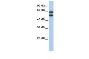 Image no. 1 for anti-Zinc Finger Protein 331 (ZNF331) (AA 51-100) antibody (ABIN6737784) (ZNF331 抗体  (AA 51-100))