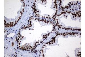 Image no. 4 for anti-Zinc Finger and SCAN Domain Containing 18 (ZSCAN18) antibody (ABIN1501861)