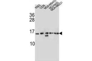 Western Blotting (WB) image for anti-Histone Cluster 1, H2ab (HIST1H2AB) antibody (ABIN2997115) (HIST1H2AB 抗体)