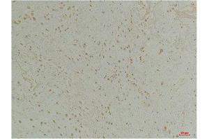 Immunohistochemistry (IHC) analysis of paraffin-embedded Human Colon Tissue using CLIC1 Rabbit Polyclonal Antibody diluted at 1:200. (CLIC1 抗体)