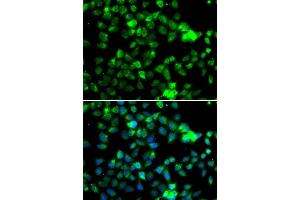 Immunofluorescence analysis of A-549 cells using NAA20 antibody. (NAT5 抗体  (AA 49-178))