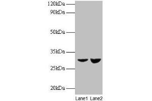 Western blot All lanes: UQCRFS1 antibody at 2 μg/mL Lane 1: EC109 whole cell lysate Lane 2: 293T whole cell lysate Secondary Goat polyclonal to rabbit IgG at 1/15000 dilution Predicted band size: 30 kDa Observed band size: 30 kDa (UQCRFS1 抗体  (AA 79-274))