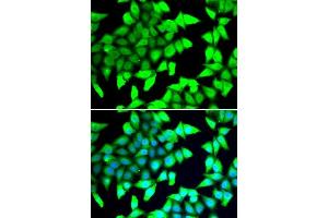 Immunofluorescence analysis of A549 cells using HDAC5 antibody. (HDAC5 抗体  (AA 350-450))