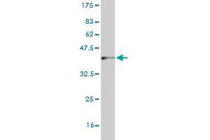 Western Blot detection against Immunogen (37. (CNDP2 抗体  (AA 191-300))
