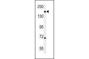 DI3L1 Antibody (N-term) (ABIN651802 and ABIN2840405) western blot analysis in mouse heart tissue lysates (15 μg/lane). (DIS3L 抗体  (N-Term))