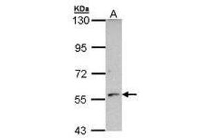 Image no. 1 for anti-Cytochrome P450, Family 21, Subfamily A, Polypeptide 2 (CYP21A2) (AA 120-386) antibody (ABIN467561) (CYP21A2 抗体  (AA 120-386))