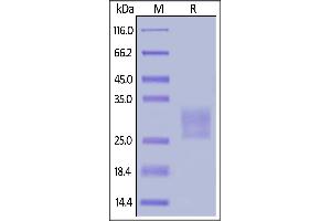 Human Frizzled-7, His Tag on  under reducing (R) condition. (FZD7 Protein (AA 33-185) (His tag))