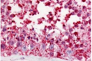 Human Testis (formalin-fixed, paraffin-embedded) stained with GPR18 antibody ABIN213636 at 10 ug/ml followed by biotinylated goat anti-rabbit IgG secondary antibody ABIN481713, alkaline phosphatase-streptavidin and chromogen. (GPR18 抗体  (Cytoplasmic Domain))