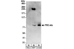 Western Blotting (WB) image for anti-Protein Kinase C, eta (PRKCH) (AA 633-683) antibody (ABIN7450569)