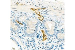 Immunohistochemistry (Paraffin-embedded Sections) (IHC (p)) image for anti-Mucosal Vascular Addressin Cell Adhesion Molecule 1 (MADCAM1) antibody (ABIN7074695)