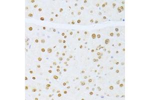 Immunohistochemistry of paraffin-embedded mouse pancreas using ETV1 antibody (ABIN6129794, ABIN6140327, ABIN6140329 and ABIN6217250) at dilution of 1:100 (40x lens). (ETV1 抗体  (AA 80-300))