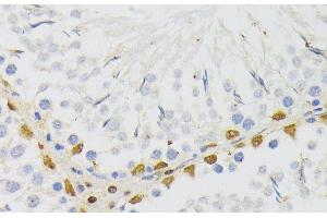 Immunohistochemistry of paraffin-embedded Rat testis using ELAC2 Polyclonal Antibody at dilution of 1:200 (40x lens). (ELAC2 抗体)