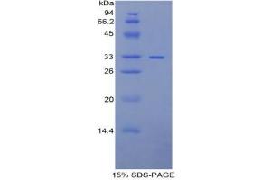 SDS-PAGE analysis of Rat MP1 Protein. (PITRM1 蛋白)