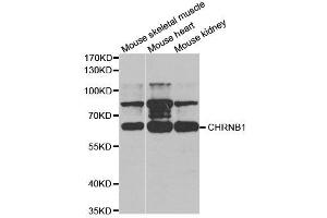 Western Blotting (WB) image for anti-Nicotinic Acetylcholine Receptor beta (CHRNB1) antibody (ABIN1876483) (CHRNB1 抗体)