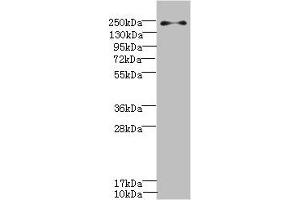 Western blot All lanes: PLA2R1 antibody IgG at 0. (PLA2R1 抗体  (AA 870-1130))