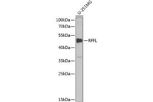 Western blot analysis of extracts of U-251MG cells, using RFFL antibody (ABIN6130665, ABIN6146886, ABIN6146888 and ABIN6222152) at 1:1000 dilution.
