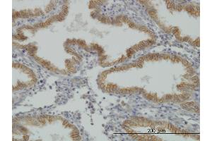 Immunoperoxidase of monoclonal antibody to MUSK on formalin-fixed paraffin-embedded human endometrium. (MUSK 抗体  (AA 301-400))