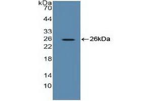 Detection of Recombinant EEF2, Human using Polyclonal Antibody to Eukaryotic Translation Elongation Factor 2 (EEF2) (EEF2 抗体  (AA 32-233))