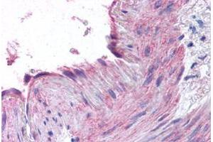 Immunohistochemical staining of human small intestine, vessel with CCR1 polyclonal antibody . (CCR1 抗体  (N-Term))