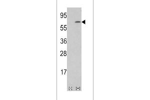 Western blot analysis of lysate from human placenta tissue lysate, using M-CSF Antibody at 1:1000 at each lane.