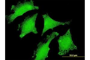 Immunofluorescence of monoclonal antibody to DND1 on HeLa cell. (DND1 抗体  (AA 167-260))