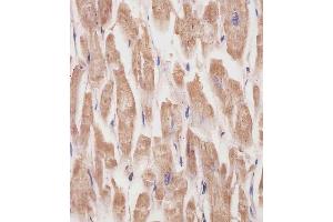 (ABIN6242162 and ABIN6577231) staining KANK1 in human heart tissue sections by Immunohistochemistry (IHC-P - paraformaldehyde-fixed, paraffin-embedded sections). (ANKRD15 抗体)