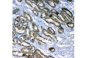 IHC analysis of Glycerol kinase using anti-Glycerol kinase antibody . (Glycerol Kinase 抗体  (AA 1-180))