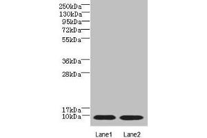 Western blot All lanes: NOP10 antibody at 4 μg/mL Lane 1: Jurkat whole cell lysate Lane 2: Caco-2 whole cell lysate Secondary Goat polyclonal to rabbit IgG at 1/10000 dilution Predicted band size: 8 kDa Observed band size: 8 kDa (rRNA 2'-O-Methyltransferase Fibrillarin (FBL) (AA 1-64) 抗体)