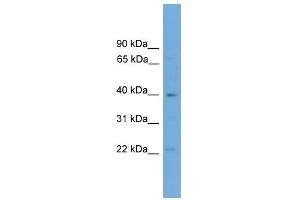 WB Suggested Anti-Dmrtb1 Antibody Titration: 0. (DMRTB1 抗体  (C-Term))