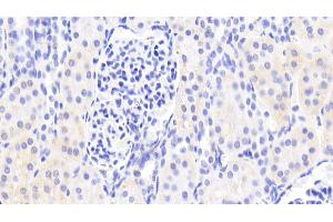 Detection of DHODH in Human Kidney Tissue using Polyclonal Antibody to Dihydroorotate Dehydrogenase (DHODH) (DHODH 抗体  (AA 35-392))