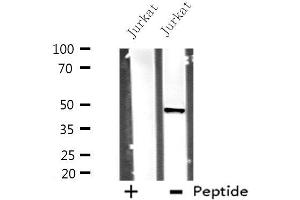 Western blot analysis of extracts from Jurkat cells, using DHODH antibody. (DHODH 抗体  (Internal Region))