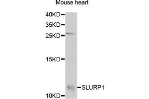 Western blot analysis of extracts of Mouse heart cells, using SLURP1 antibody. (SLURP1 抗体)