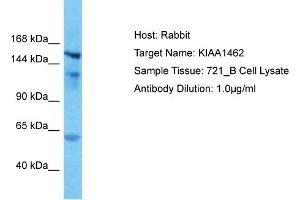Host: Rabbit Target Name: KIAA1462 Sample Type: 721_B Whole Cell lysates Antibody Dilution: 1. (JCAD/KIAA1462 抗体  (N-Term))
