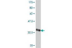 Western Blot detection against Immunogen (36. (RING1 抗体  (AA 81-170))