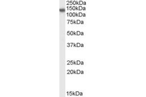 Western Blotting (WB) image for anti-Disabled Homolog 2, Mitogen-Responsive phosphoprotein (Drosophila) (DAB2) (N-Term) antibody (ABIN2156670) (DAB2 抗体  (N-Term))