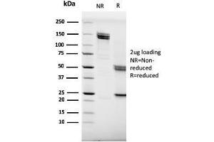 SDS-PAGE Analysis Purified CD20 Mouse Monoclonal Antibody (MS4A1/3409).