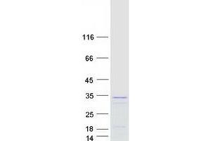 Western Blotting (WB) image for General Transcription Factor IIF, Polypeptide 2, 30kDa (GTF2F2) protein (Myc-DYKDDDDK Tag) (ABIN2722317)