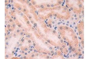 Detection of XDH in Mouse Kidney Tissue using Polyclonal Antibody to Xanthine Dehydrogenase (XDH)