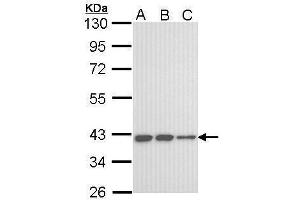 WB Image Sample (30 ug of whole cell lysate) A: A431 , B: H1299 C: Hela 10% SDS PAGE antibody diluted at 1:1000 (KIR3DL2 抗体  (C-Term))