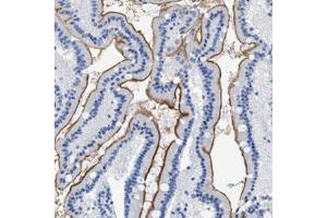 Immunohistochemical staining (Formalin-fixed paraffin-embedded sections) of human duodenum with DLC1 polyclonal antibody  shows distinct positivity of microvilli in glandular cells. (DLC1 抗体)