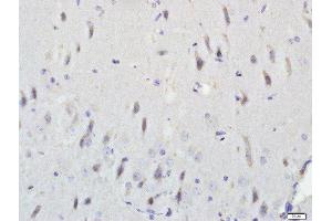 Immunohistochemistry (Paraffin-embedded Sections) (IHC (p)) image for anti-phosphodiesterase 7B (PDE7B) (AA 281-360) antibody (ABIN1386171)