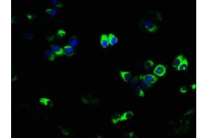 Immunofluorescence staining of PC-3 cells with ABIN7173843 at 1:133, counter-stained with DAPI. (TNFRSF11A 抗体  (AA 28-202))