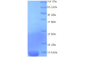 SDS-PAGE (SDS) image for Chemokine (C-C Motif) Ligand 2 (CCL2) (AA 24-96), (partial) protein (His tag) (ABIN5712650)