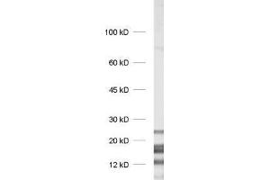dilution: 1 : 1000, sample: rat brain homogenate (MBP 抗体)