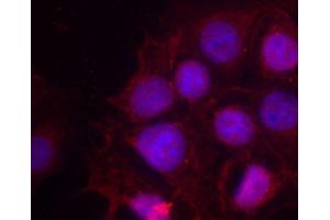 Immunofluorescence staining of methanol-fixed MCF-7 cells using Phospho-ESR1-S118 antibody (ABIN2987431). (Estrogen Receptor alpha 抗体  (pSer118))