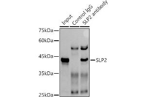 Immunoprecipitation analysis of 300 μg extracts of A-549 cells using 3 μg SLP2 antibody (ABIN7270675). (SYTL2 抗体)
