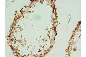 Immunohistochemistry of paraffin-embedded human testis tissue using ABIN7149304 at dilution of 1:100