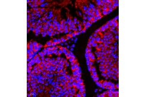 Immunofluorescence (Paraffin-embedded Sections) (IF (p)) image for anti-Signal Recognition Particle 14kDa (Homologous Alu RNA Binding Protein) (SRP14) antibody (ABIN7075596)