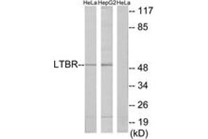 Western blot analysis of extracts from HeLa/HepG2 cells, using LTBR Antibody. (LTBR 抗体  (AA 11-60))